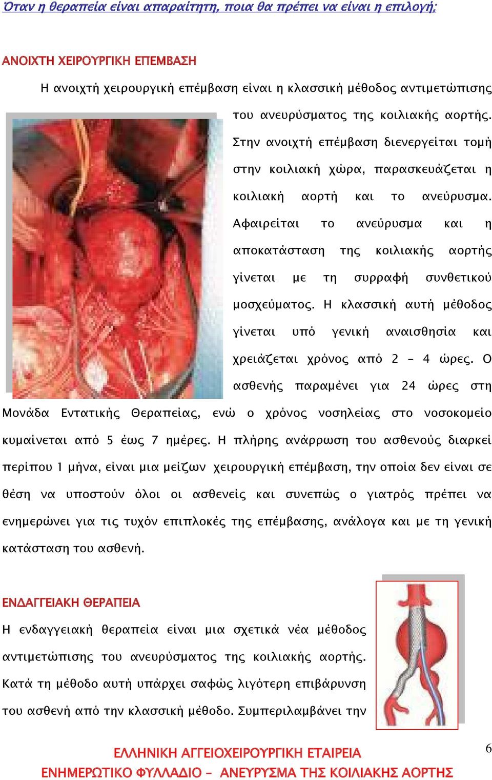 Αφαιρείται το ανεύρυσμα και η αποκατάσταση της κοιλιακής αορτής γίνεται με τη συρραφή συνθετικού μοσχεύματος. Η κλασσική αυτή μέθοδος γίνεται υπό γενική αναισθησία και χρειάζεται χρόνος από 2 4 ώρες.