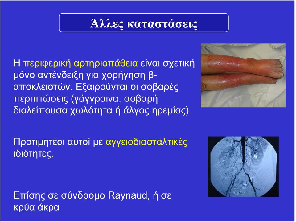 Εξαιρούνταιοισοβαρές περιπτώσεις (γάγγραινα, σοβαρή διαλείπουσα