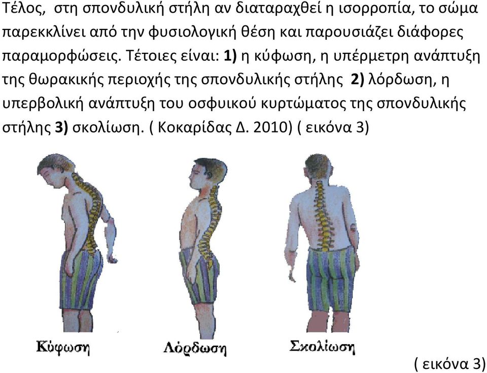 Τέτοιες είναι: 1) η κύφωση, η υπέρμετρη ανάπτυξη της θωρακικής περιοχής της σπονδυλικής