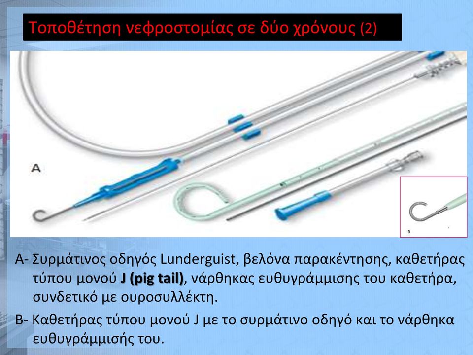 νάρθηκας ευθυγράμμισης του καθετήρα, συνδετικό με ουροσυλλέκτη.