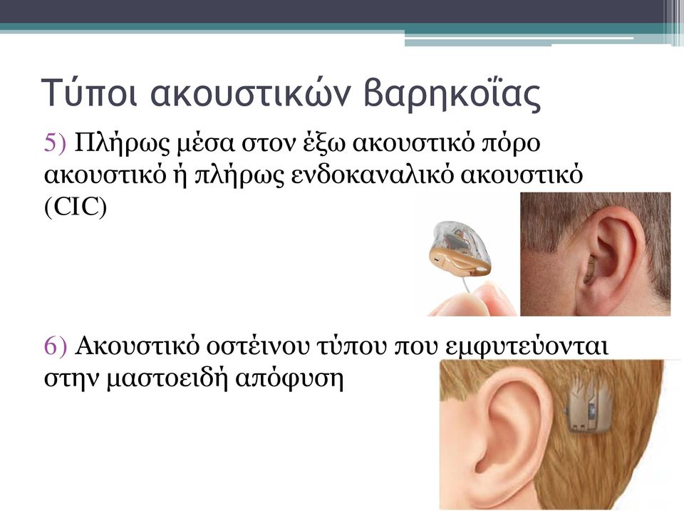 ενδοκαναλικό ακουστικό (CIC) 6) Ακουστικό