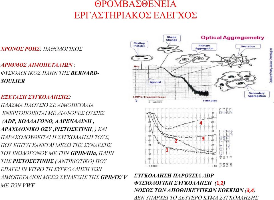 ΕΠΙΤΥΓΧΑΝΕΤΑΙ ΜΕΣΩ ΤΗΣ ΣΥΝΔΕΣΗΣ ΤΟΥΙΝΩΔΟΓΟΝΟΥΜΕΤΗΝGPIIb/IIIa, ΠΛΗΝ ΤΗΣ ΡΙΣΤΟΣΕΤΙΝΗΣ ( ΑΝΤΙΒΙΟΤΙΚΟ) ΠΟΥ ΕΠΑΓΕΙ IN VITRO ΤΗ ΣΥΓΚΟΛΛΗΣΗ ΤΩΝ ΑΙΜΟΠΕΤΑΛΙΩΝ ΜΕΣΩ