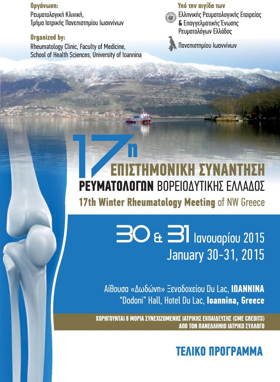 ΡΕΥΜΑΤΟΛΟΓΩΝ ΒΟΡΕΙΟΔΥΤΙΚΗΣ ΕΛΛΑΔΟΣ 17th Winter Rheumatology Meeting of NW Greece 30 & 31 Ιανουαρίου 2015 January 30-31, 2015 Αίθουσα «Δωδώνη» Ξενοδοχείου Du Lac,