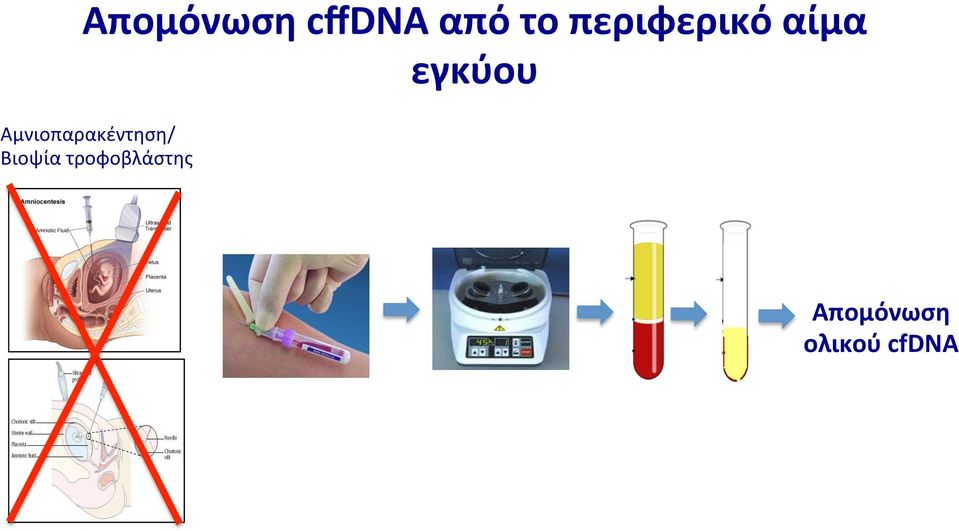 Αμνιοπαρακέντηση/ Βιοψία