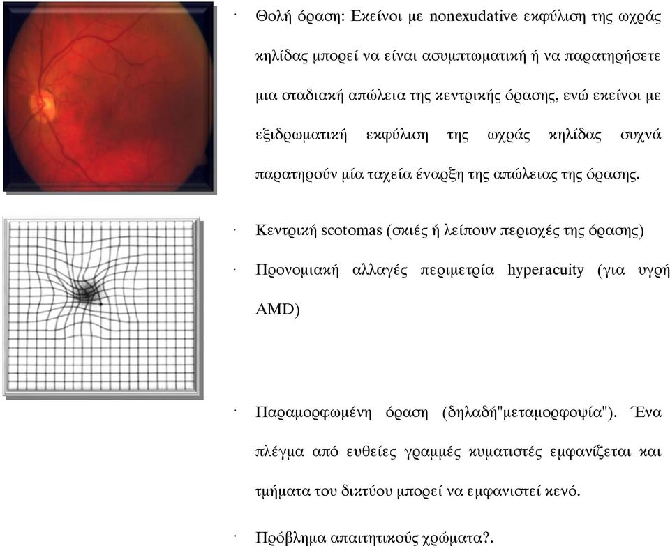 Κεντρική scotomas (σκιές ή λείπουν περιοχές της όρασης) Προνομιακή αλλαγές περιμετρία hyperacuity (για υγρή AMD) Παραμορφωμένη όραση