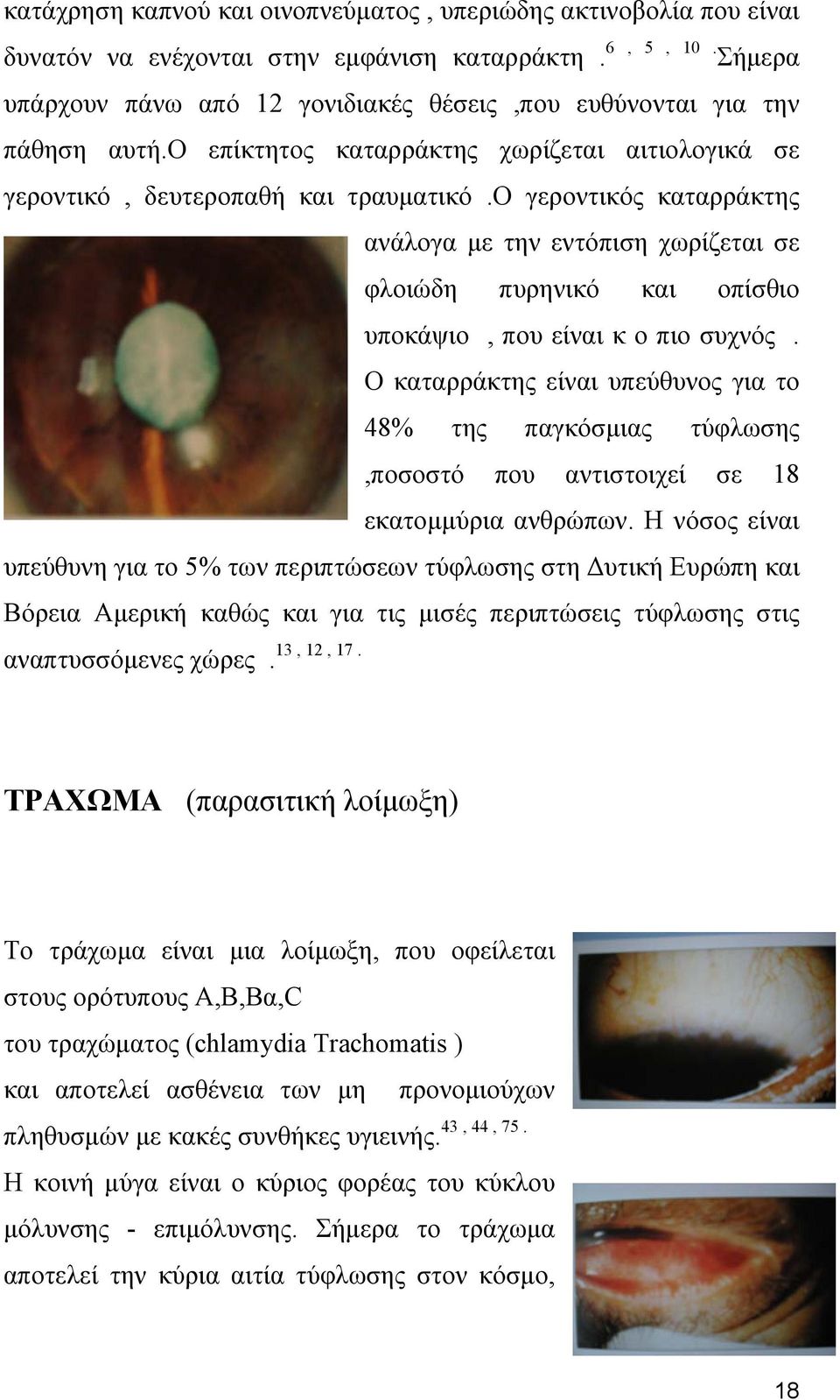ο γεροντικός καταρράκτης ανάλογα με την εντόπιση χωρίζεται σε φλοιώδη πυρηνικό και οπίσθιο υποκάψιο, που είναι κ ο πιο συχνός.