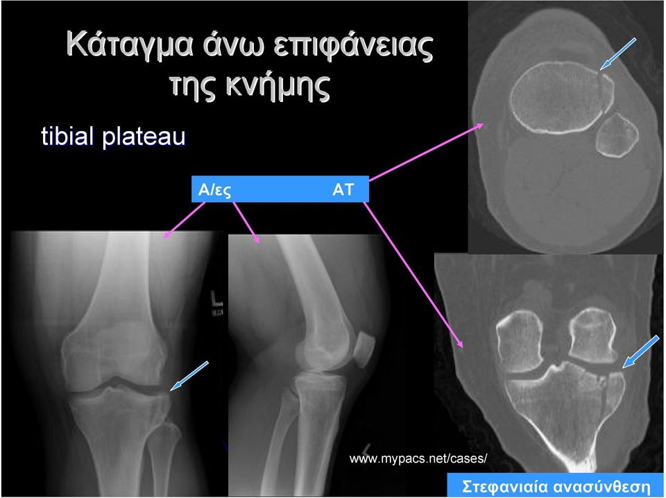 κνήμης Α/ες ΑΤ www.