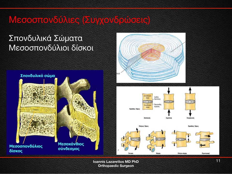 Σπονδυλικά Σώματα