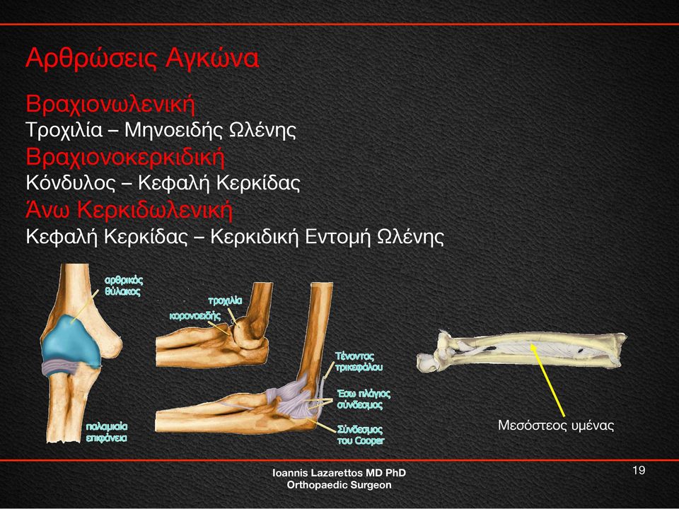Κεφαλή Κερκίδας Άνω Κερκιδωλενική Κεφαλή