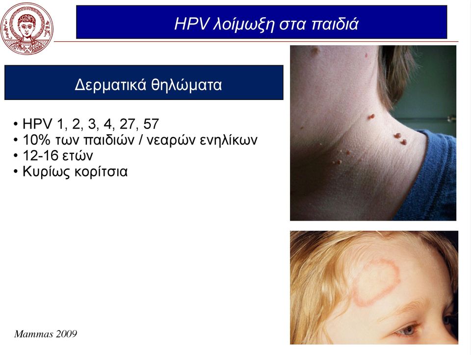 10% των παιδιών / νεαρών ενηλίκων