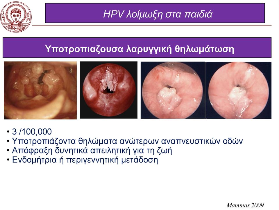 ανώτερων αναπνευστικών οδών Απόφραξη δυνητικά
