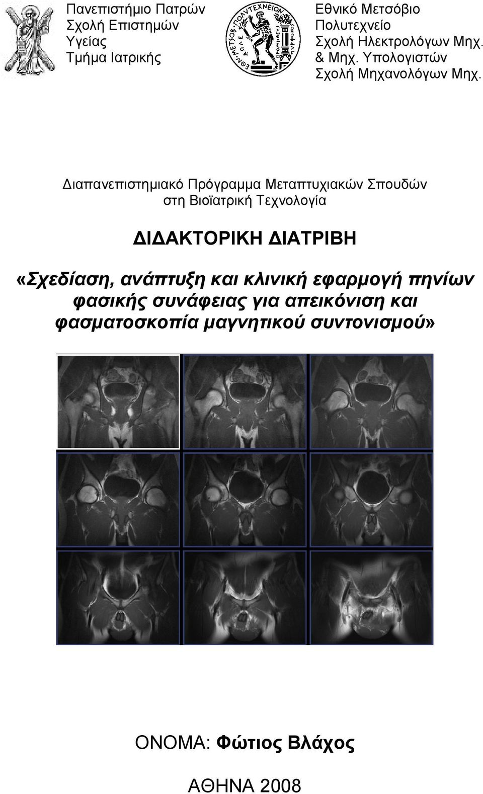 Διαπανεπιστημιακό Πρόγραμμα Μεταπτυχιακών Σπουδών στη Βιοϊατρική Τεχνολογία ΔΙΔΑΚΤΟΡΙΚΗ ΔΙΑΤΡΙΒΗ