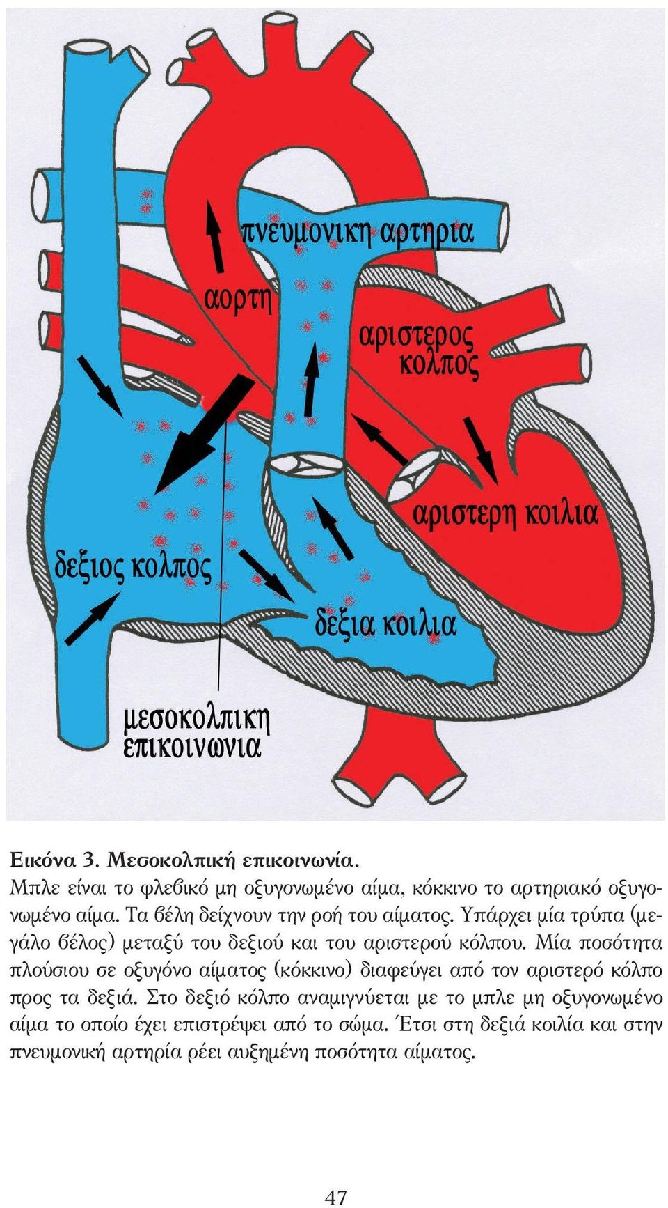 Μία ποσότητα πλούσιου σε οξυγόνο αίµατος (κόκκινο) διαφεύγει από τον αριστερό κόλπο προς τα δεξιά.