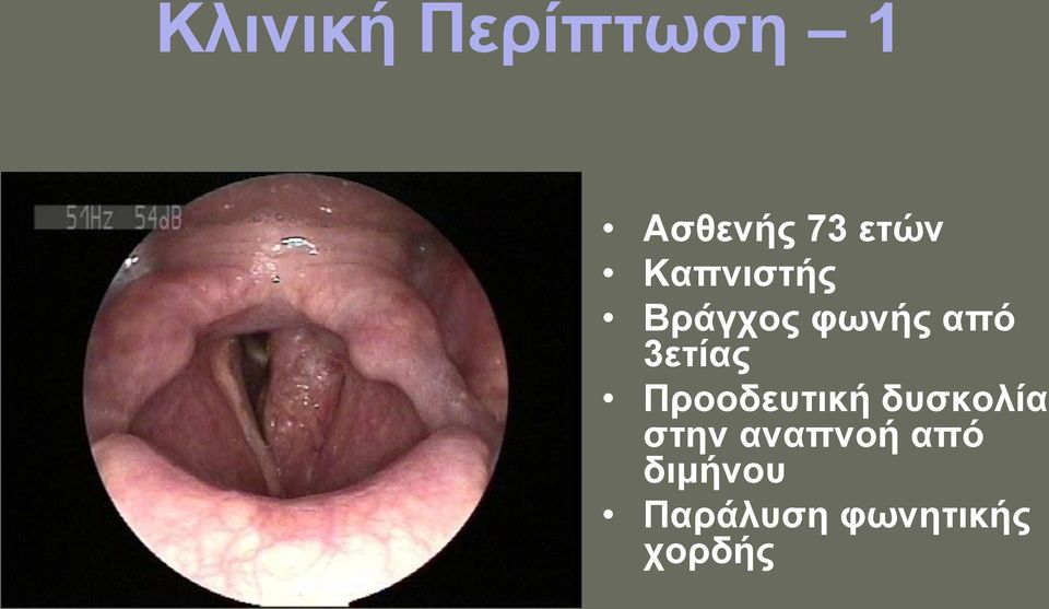 Προοδευτική δυσκολία στην αναπνοή