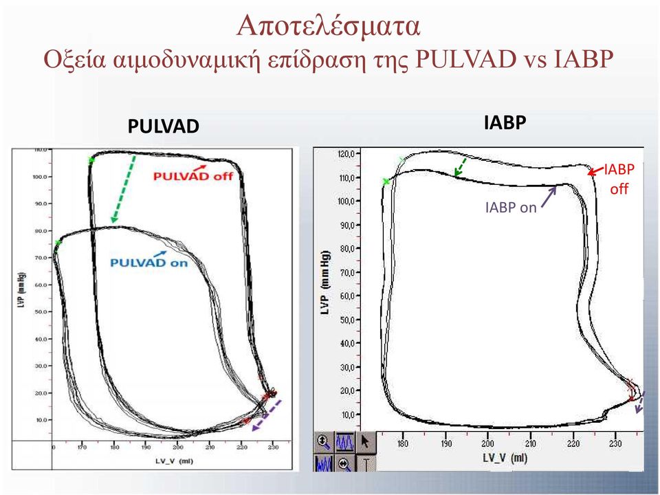 της PULVAD vs IABP