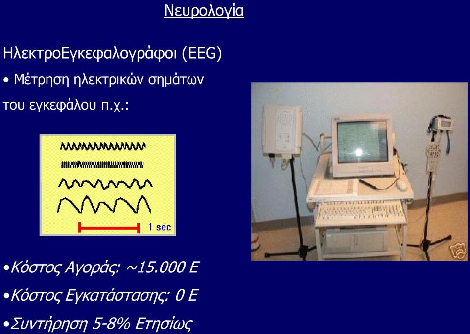 εγκεφάλου π.χ.: Κόστος Αγοράς: ~15.