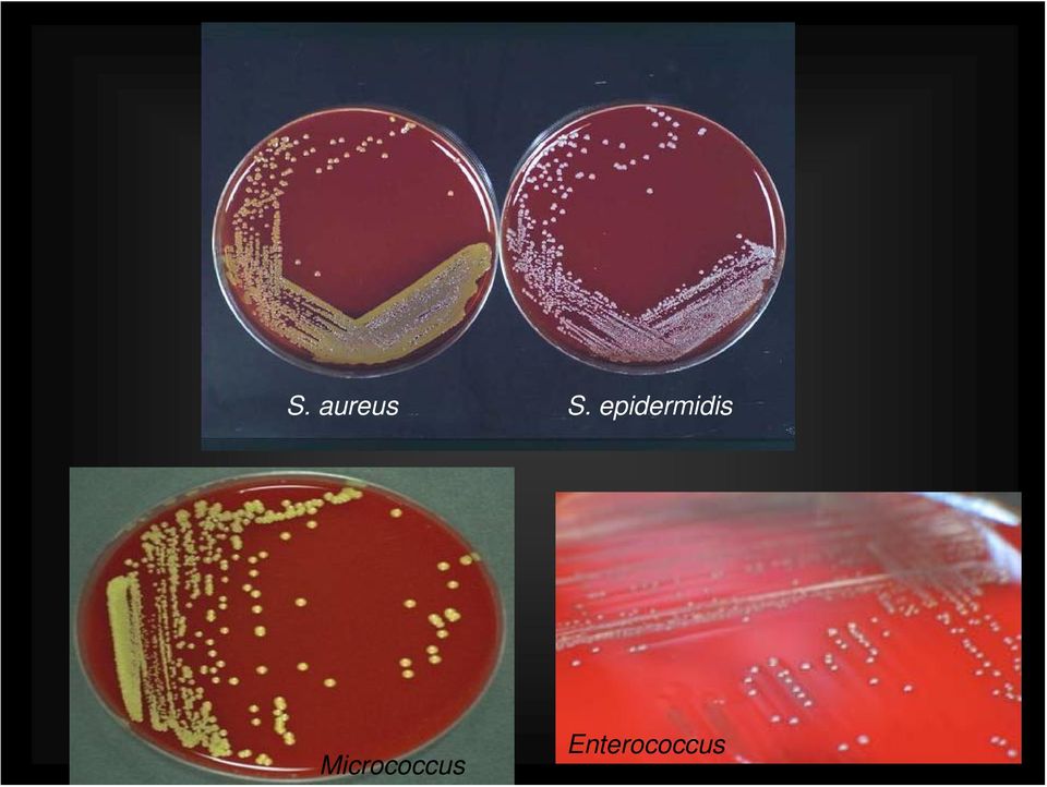 Micrococcus