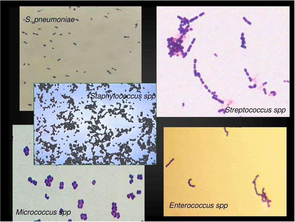 Streptococcus spp