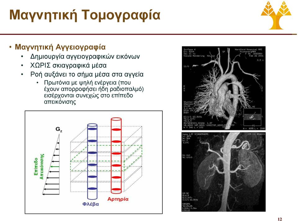 σήμα μέσα στα αγγεία Πρωτόνια με ψηλή ενέργεια (που έχουν