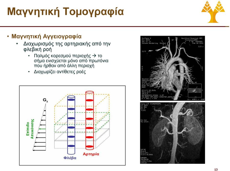 Παλμός κορεσμού περιοχής το σήμα ενισχύεται μόνο