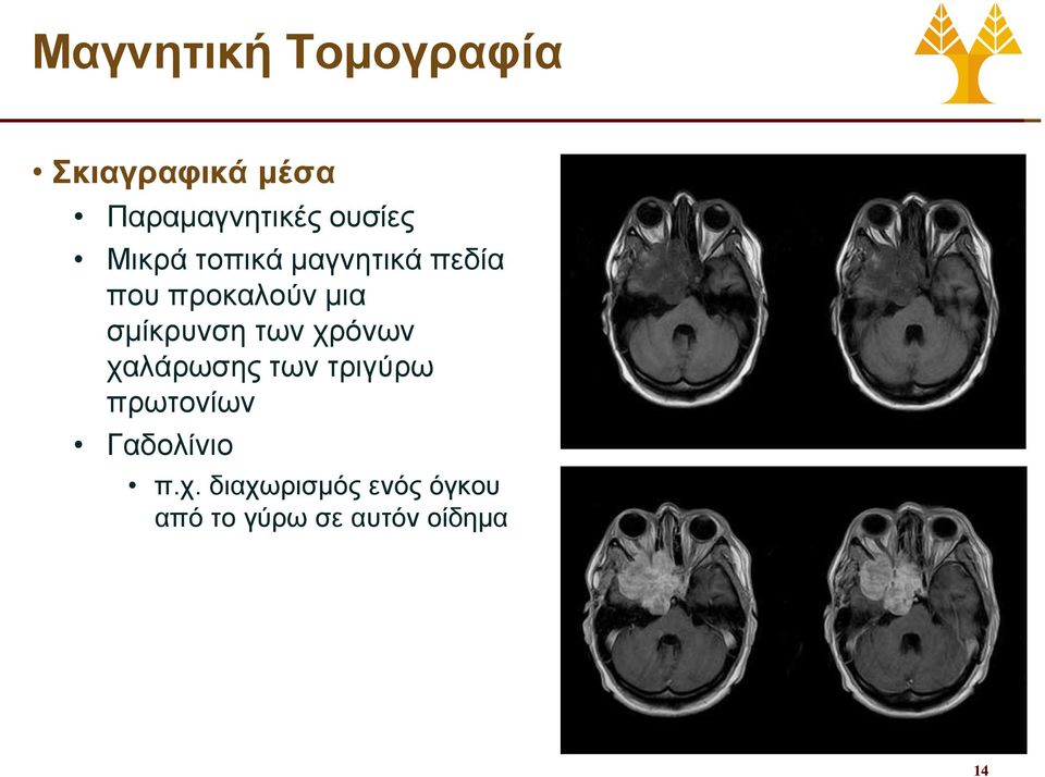 σμίκρυνση των χρόνων χαλάρωσης των τριγύρω πρωτονίων