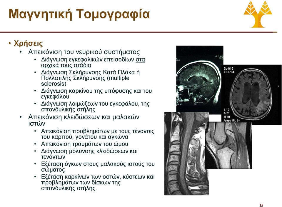 Απεικόνιση κλειδώσεων και μαλακών ιστών Απεικόνιση προβλημάτων με τους τένοντες του καρπού, γονάτου και αγκώνα Απεικόνιση τραυμάτων του ώμου Διάγνωση