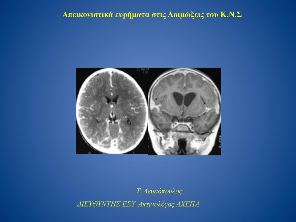 Σ Τ. Λευκόπουλος