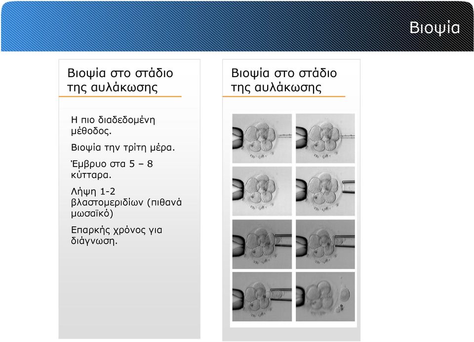 Βιοψία την τρίτη μέρα. Έμβρυο στα 5 8 κύτταρα.