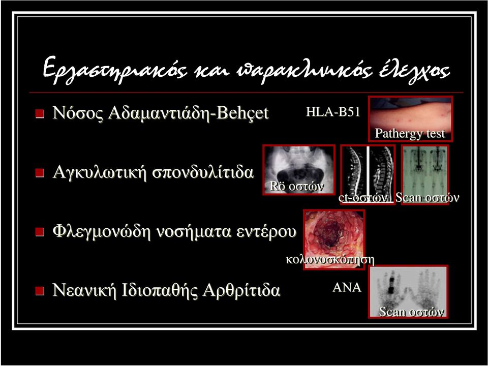 Αγκυλωτική σπονδυλίτιδα Röοστών ct-οστών Scan οστών