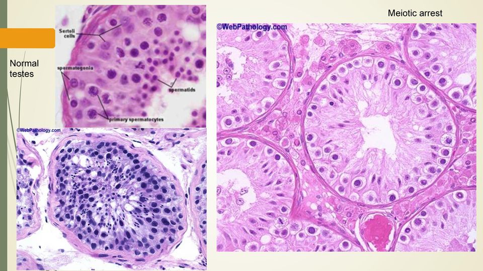 Meiotic