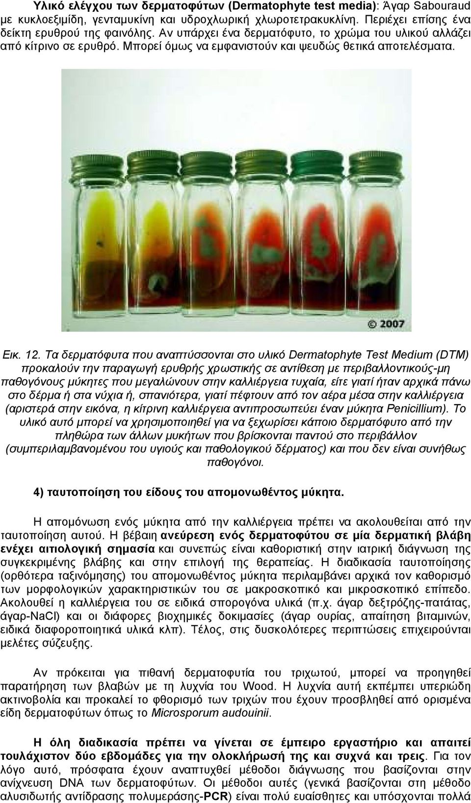 Τα δερµατόφυτα που αναπτύσσονται στο υλικό Dermatophyte Test Medium (DTM) προκαλούν την παραγωγή ερυθρής χρωστικής σε αντίθεση µε περιβαλλοντικούς-µη παθογόνους µύκητες που µεγαλώνουν στην
