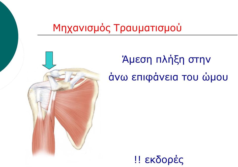 πλήξη στην άνω