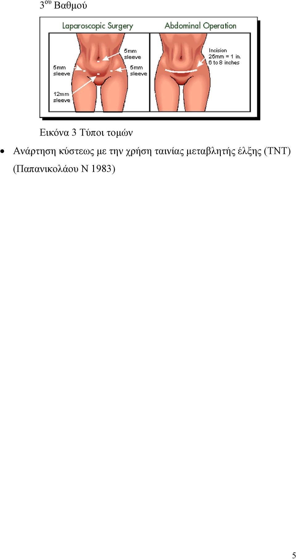 χρήση ταινίας µεταβλητής