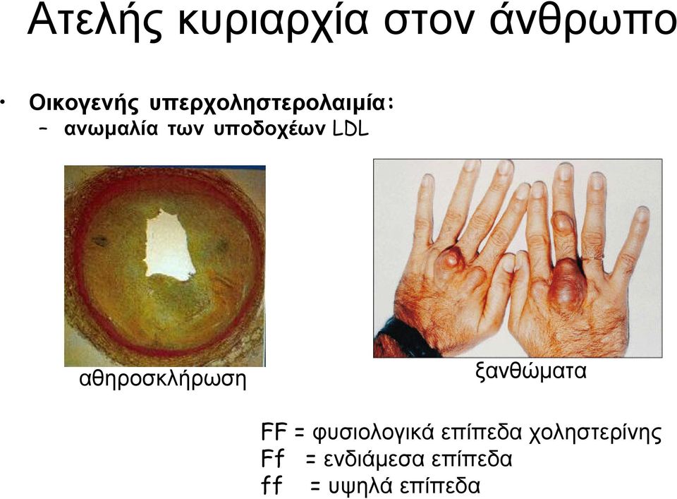 αθηροσκλήρωση ξανθώµατα FF = φυσιολογικά