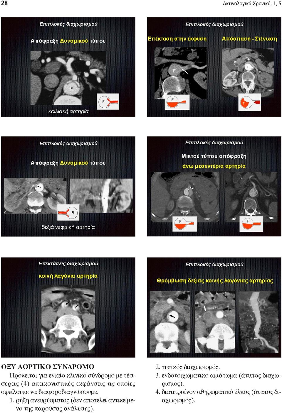 ρήξη ανευρύσματος (δεν αποτελεί αντικείμενο της παρούσας ανάλυσης). 2. τυπικός διαχωρισμός. 3.