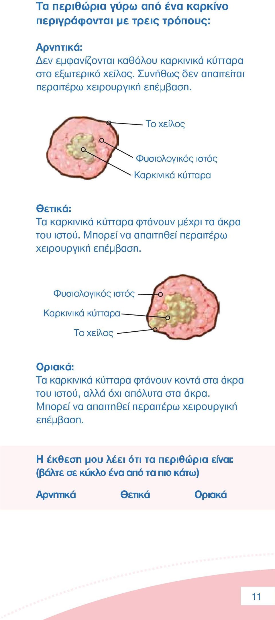 Μπορεί να απαιτηθεί περαιτέρω χειρουργική επέµβαση.