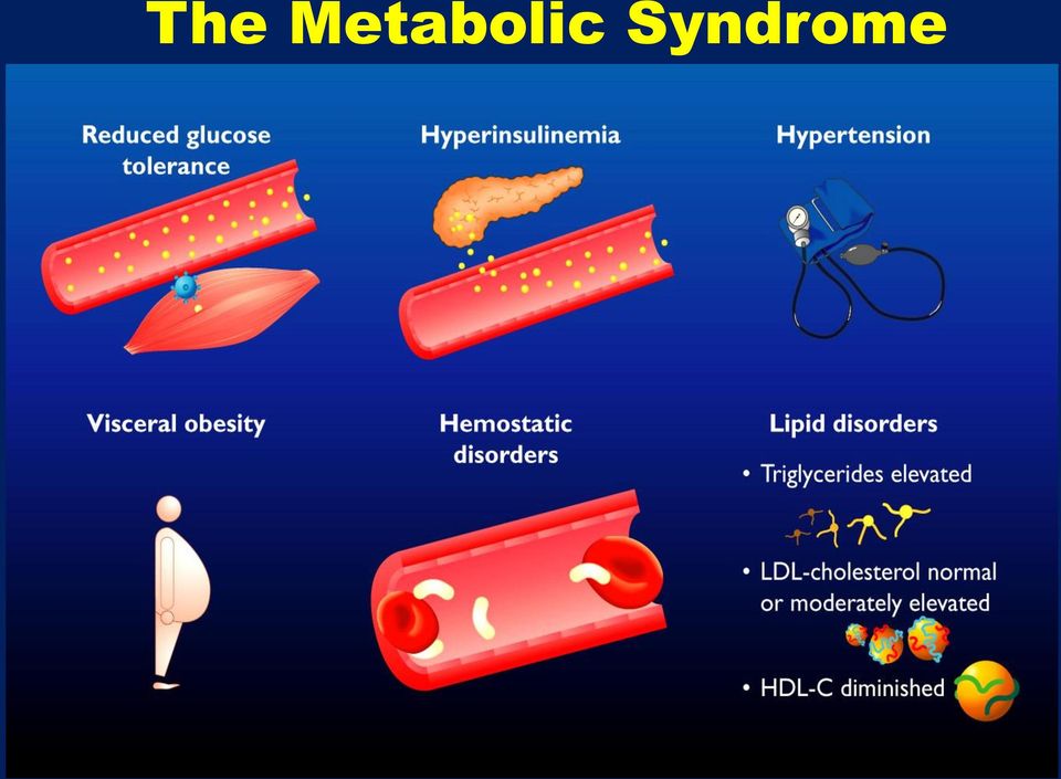 Syndrome