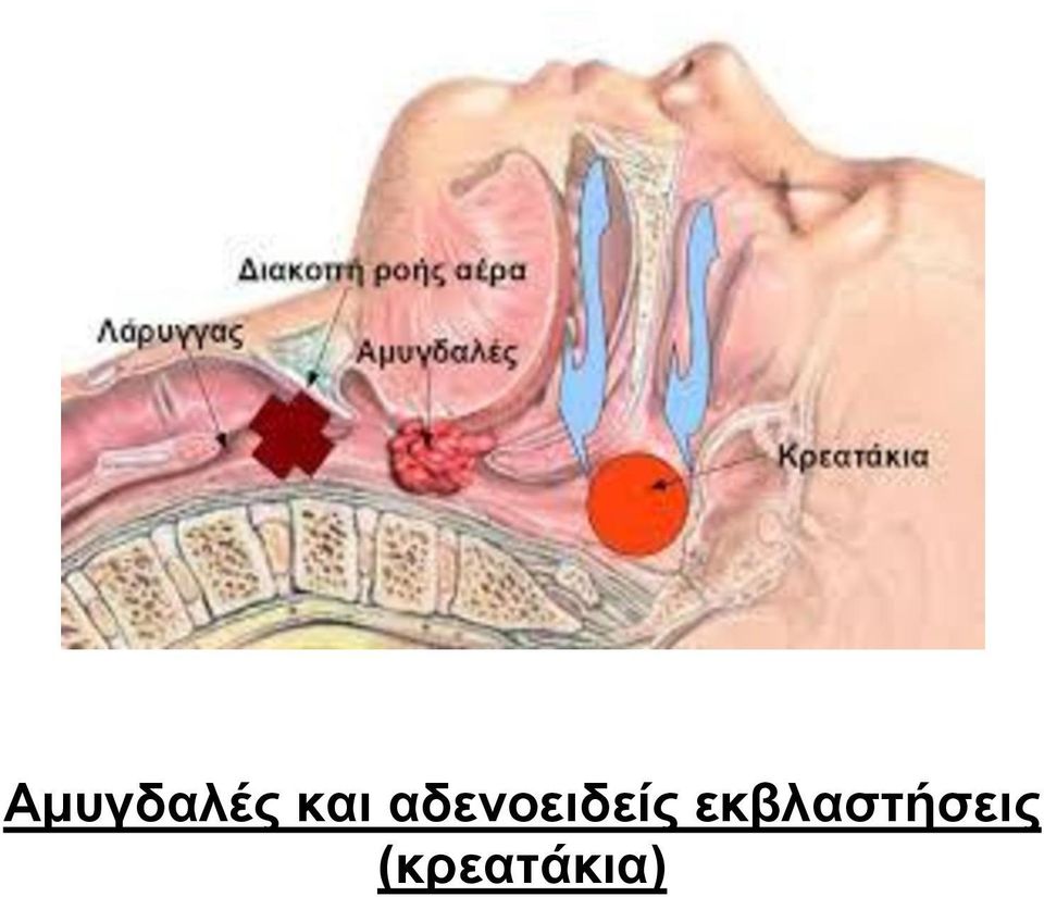 αδενοειδείς