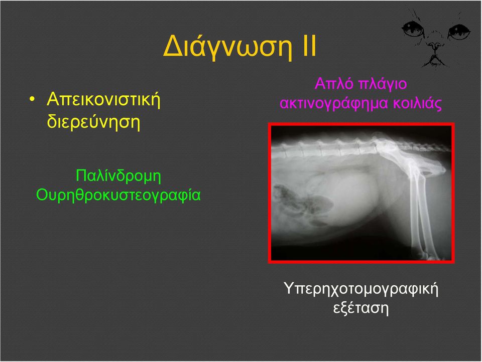 ακτινογράφημα κοιλιάς