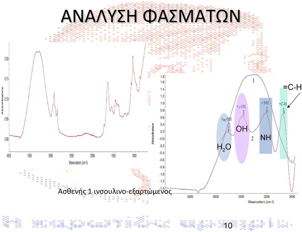 Ασθενής 1