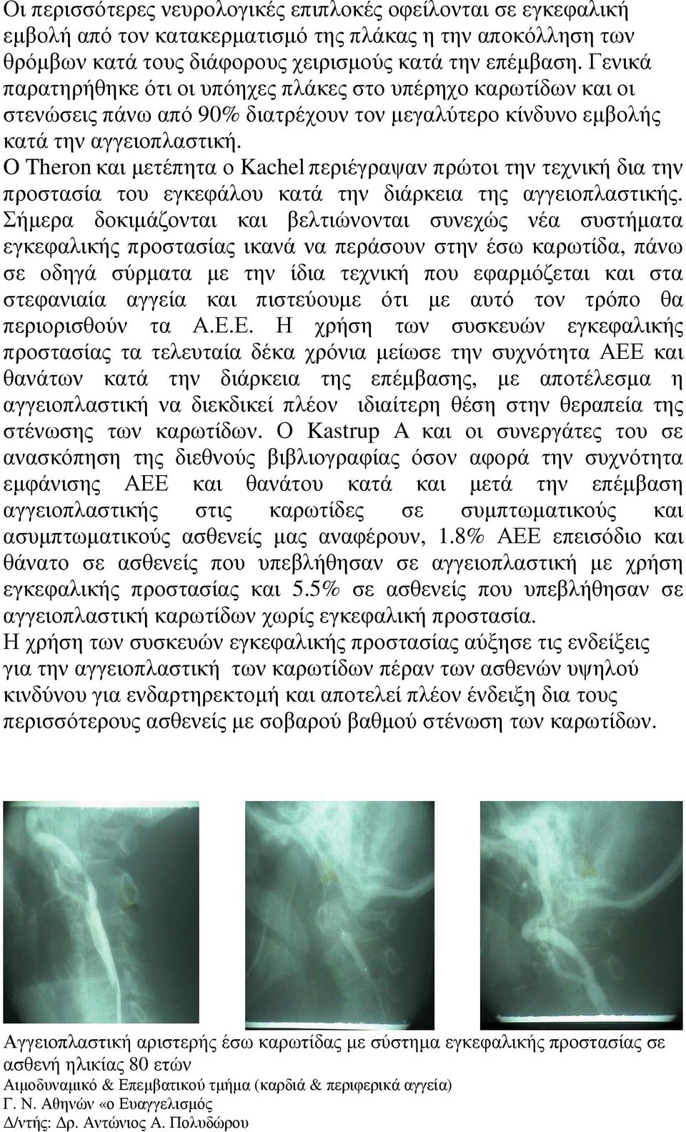 O Theronκαι µετέπητα ο Kachelπεριέγραψαν πρώτοι την τεχνική δια την προστασία του εγκεφάλου κατά την διάρκεια της αγγειοπλαστικής.