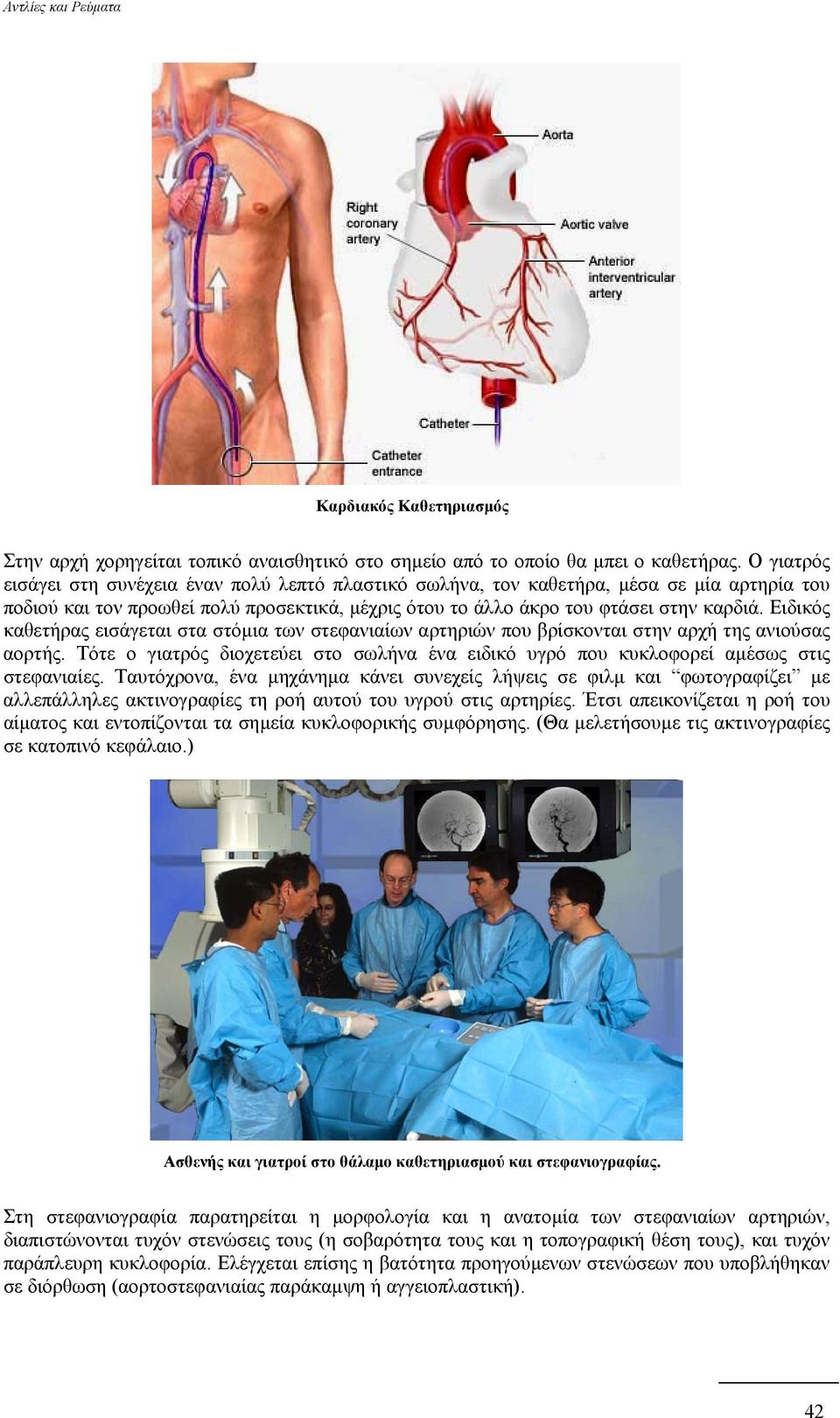 Ειδικός καθετήρας εισάγεται στα στόµια των στεφανιαίων αρτηριών που βρίσκονται στην αρχή της ανιούσας αορτής.