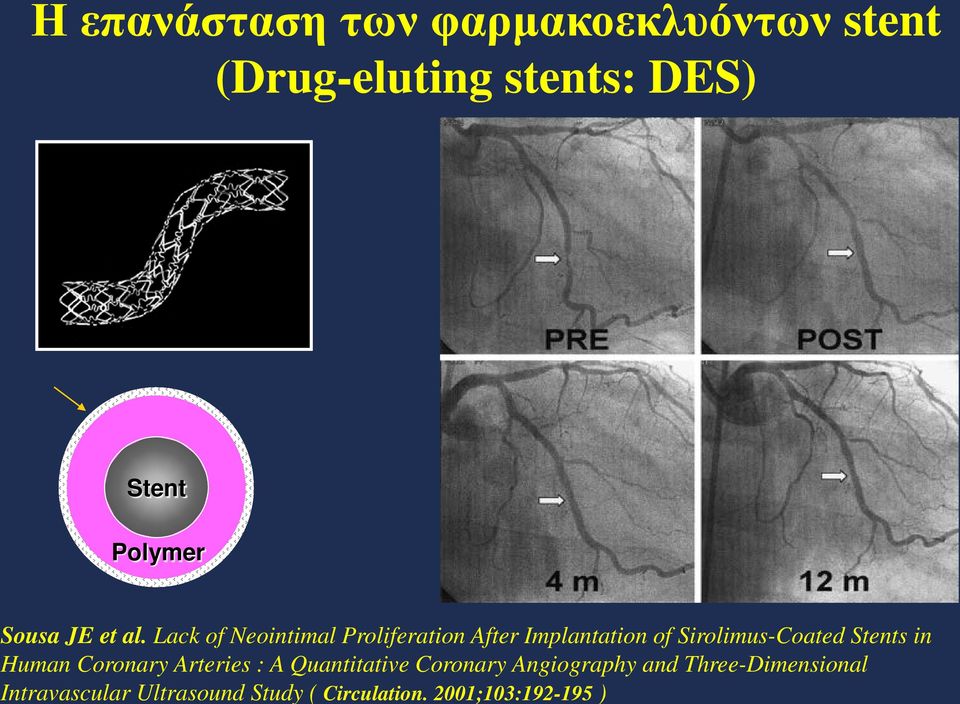 Human Coronary Arteries : A Quantitative Coronary Angiography and