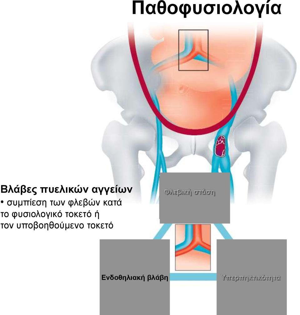 ηνθεηό ή ηνλ ππνβνεζνύκελν ηνθεηό