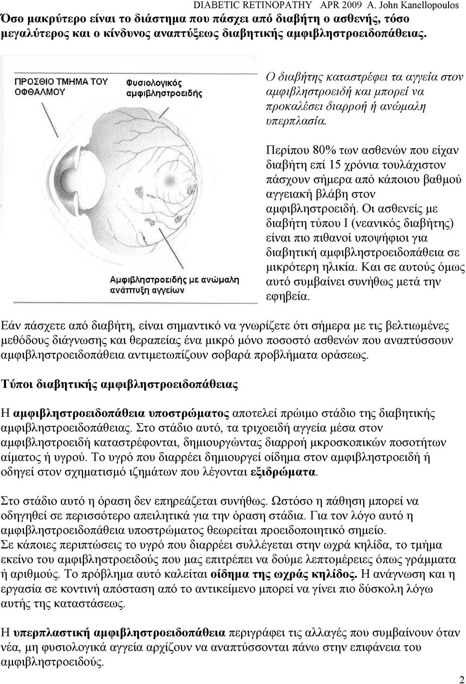Περίπου 80% των ασθενών που είχαν διαβήτη επί 15 χρόνια τουλάχιστον πάσχουν σήµερα από κάποιου βαθµού αγγειακή βλάβη στον αµφιβληστροειδή.