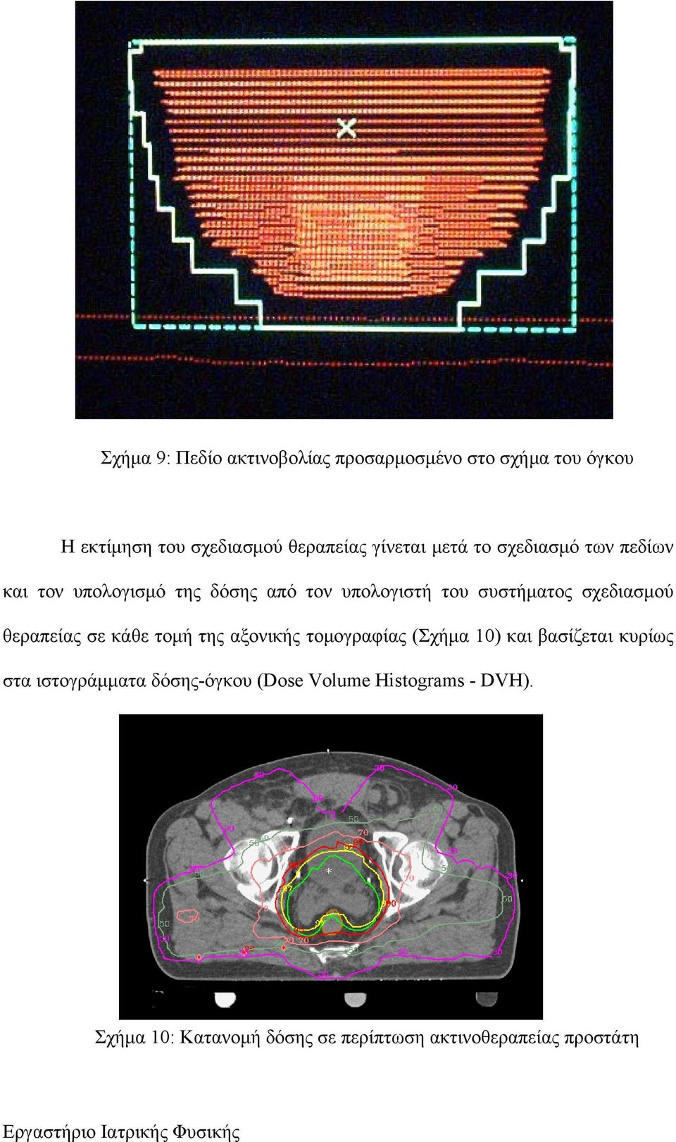 σχεδιασμού θεραπείας σε κάθε τομή της αξονικής τομογραφίας (Σχήμα 10) και βασίζεται κυρίως στα