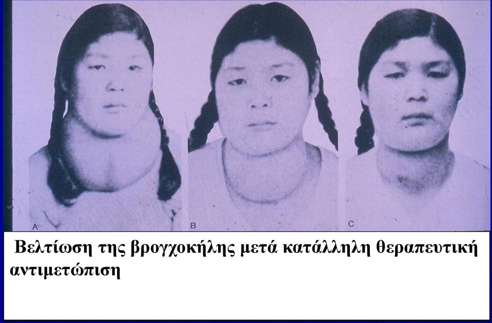 μετά κατάλληλη