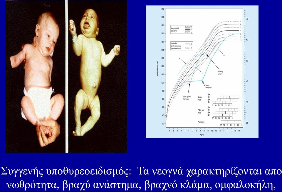 απο νωθρότητα, βραχύ
