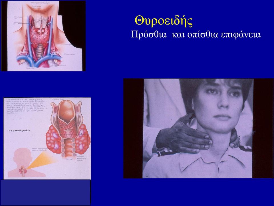 και