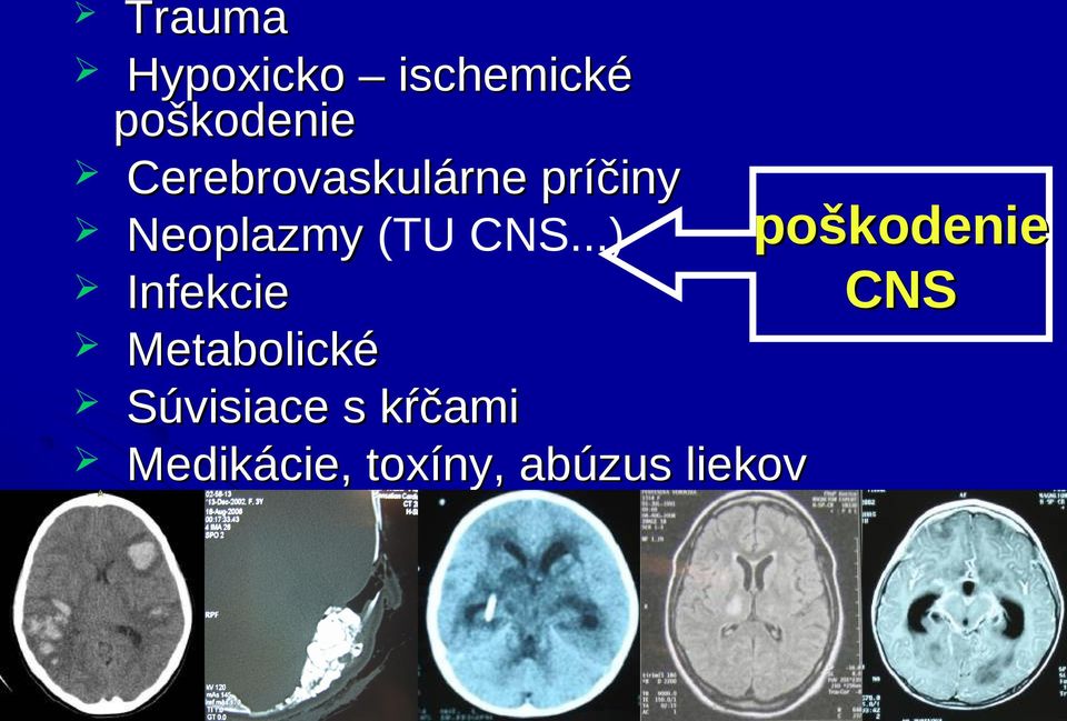 ..) Infekcie Metabolické Súvisiace s kŕčami